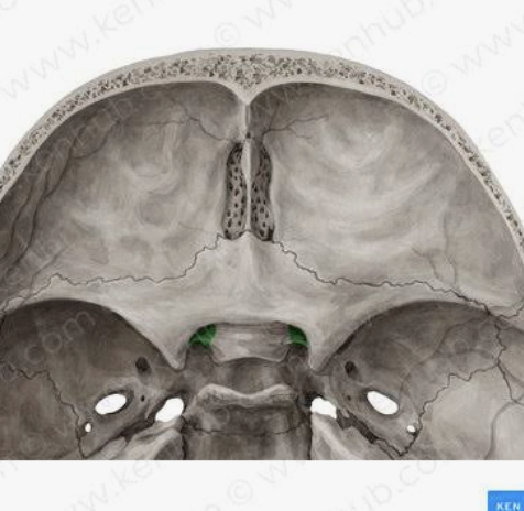 <p>What are these?</p>