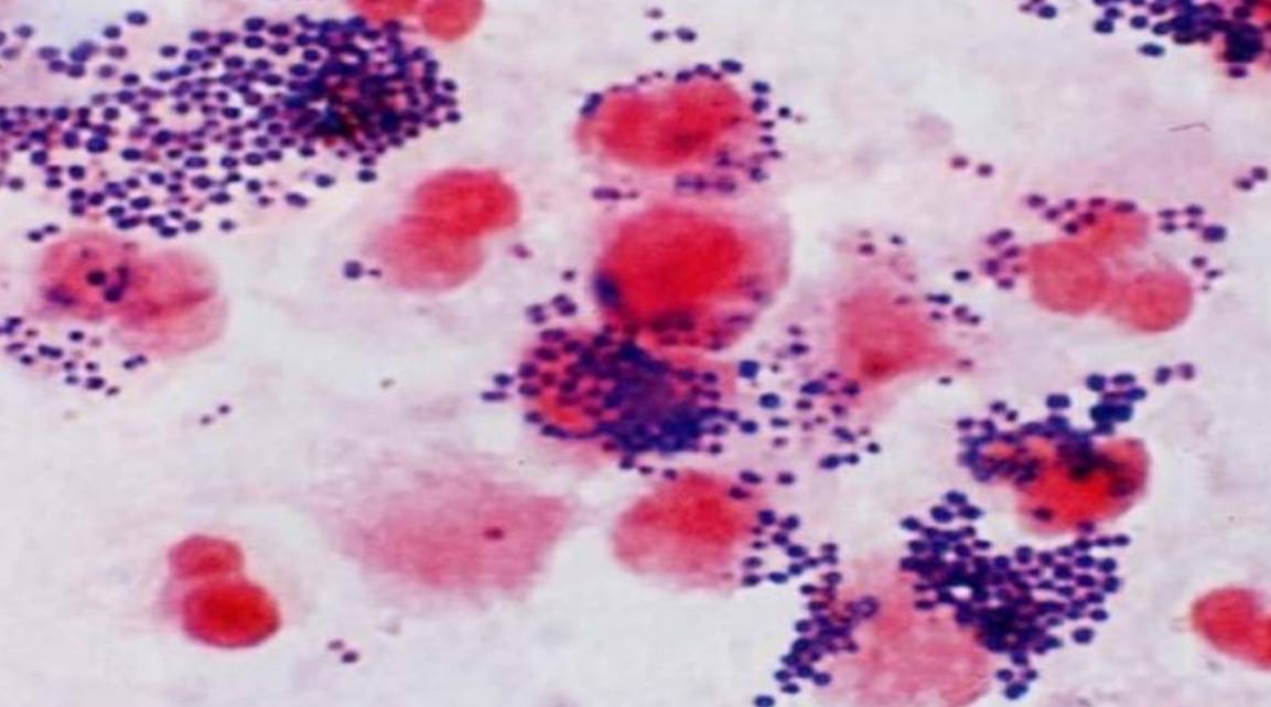 <p>Specimen (microscopically slide):</p><p>• Name of organism:</p><p>• Stain:</p><p>• Sample from: culture or pus or in tissue</p><p>• Morphology</p>
