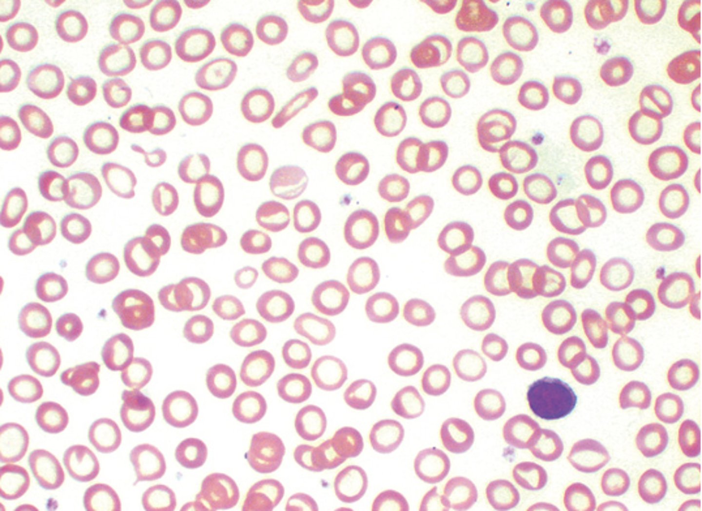 <p>Hypochromic cells seen in Fe deficiency)</p>