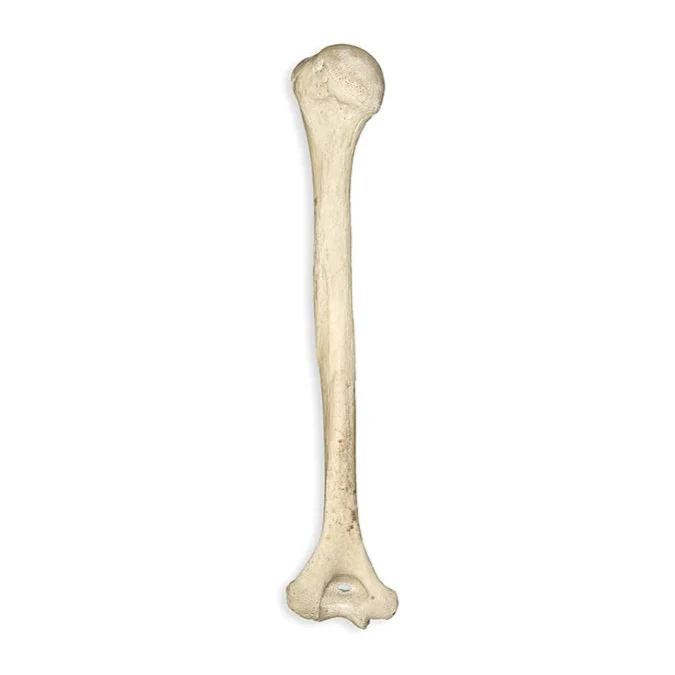 <p>What bone is this?</p>
