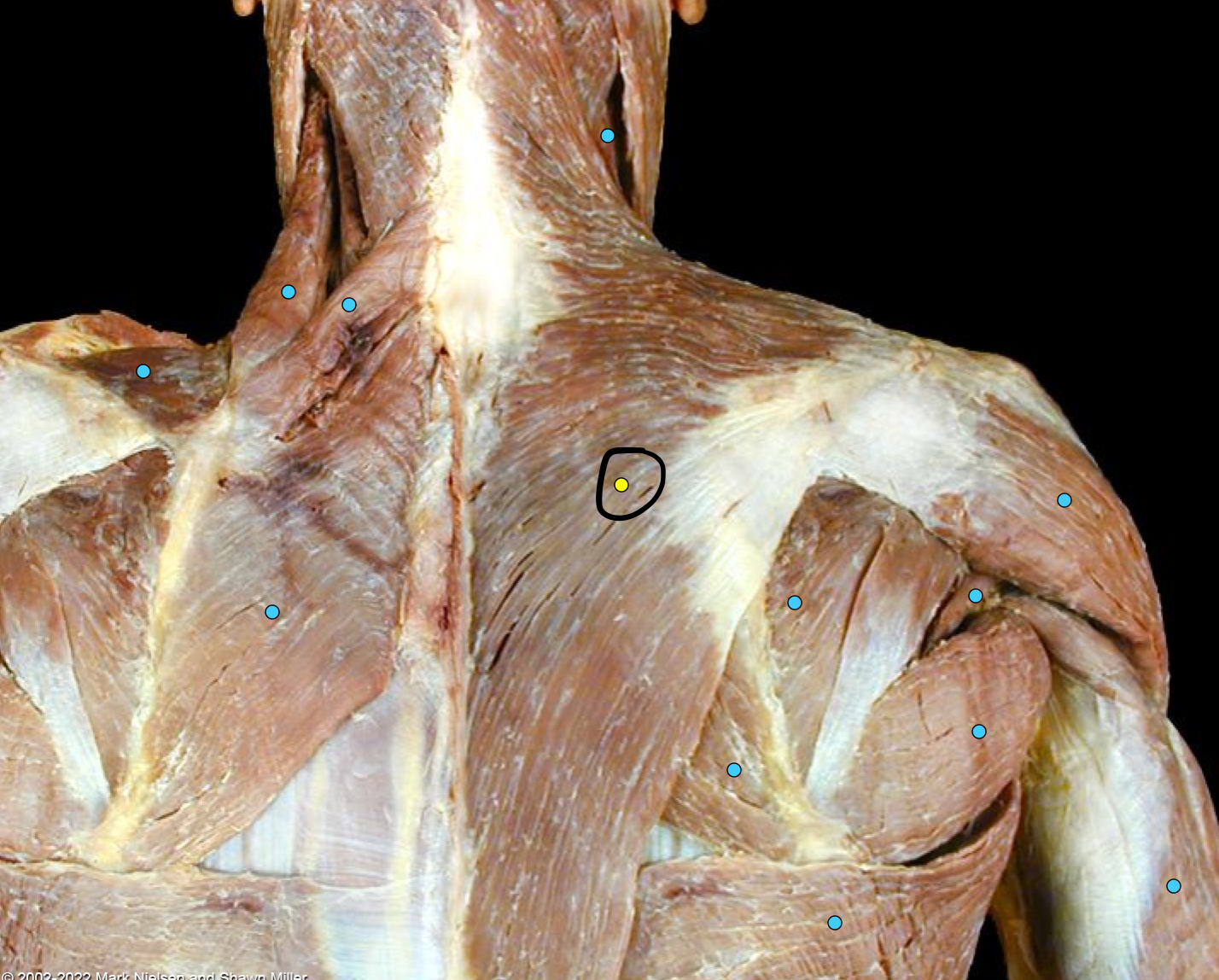 term image