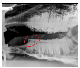 <p>What does this radiograph show?</p>