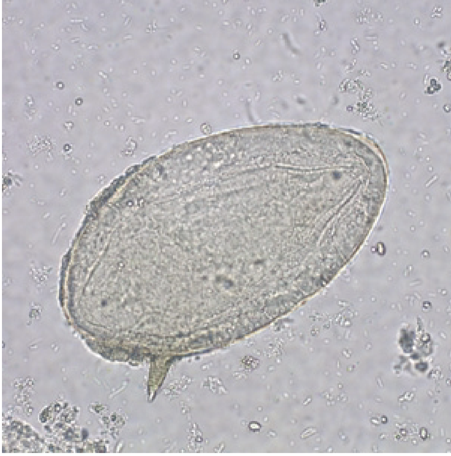 <p>-Eggs are around 150 microns long</p><ul><li><p>Lateral spine</p></li></ul><p></p>