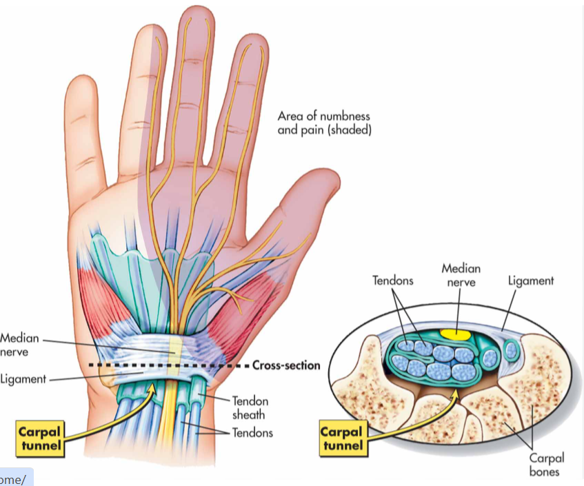 <p>Flexor retinaculum.</p>