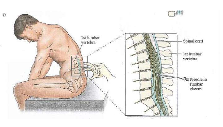 <p>From the lumbar cistern</p>
