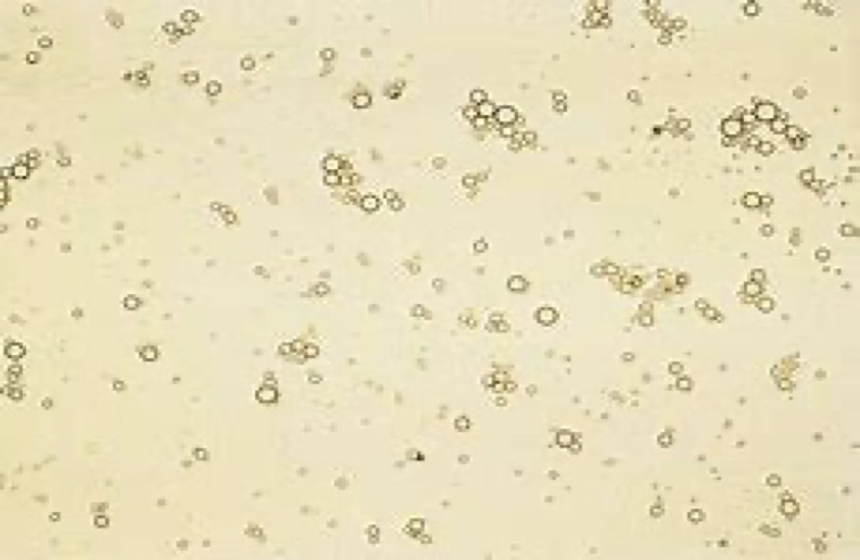 <ul><li><p>Seen to some degree in most cats.</p></li><li><p>If a prepared urine sediment on a microscope slide sits for a few minutes before being examined, this will rise to a plane of focus just beneath the coverslip.</p></li></ul><p></p>