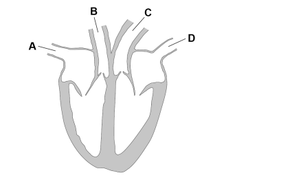 <p>2025: Name blood vessel D (1)</p>