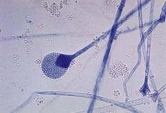 <p>Asexual zygomycota</p>
