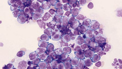 <p>What type of effusion is this?</p>