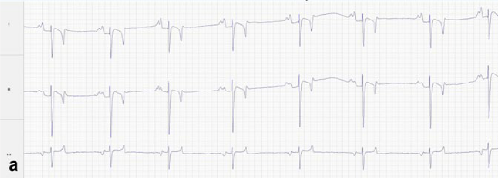 <p>Label the P wave, QRS complex, and T wave. Explain what each wave represents.</p>