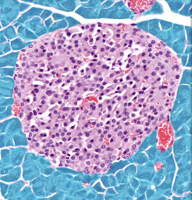 <p>pancreas acini (exocrine pancreas) </p>