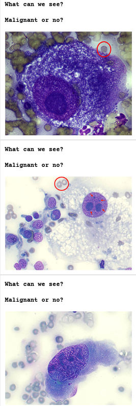 <p><span>Nucleoli Criteria of Malignancy Practice</span></p>