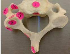 <p>what vertebrae is this </p>