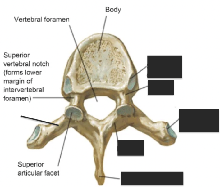 <p>what are the 5 tagged areas?</p>