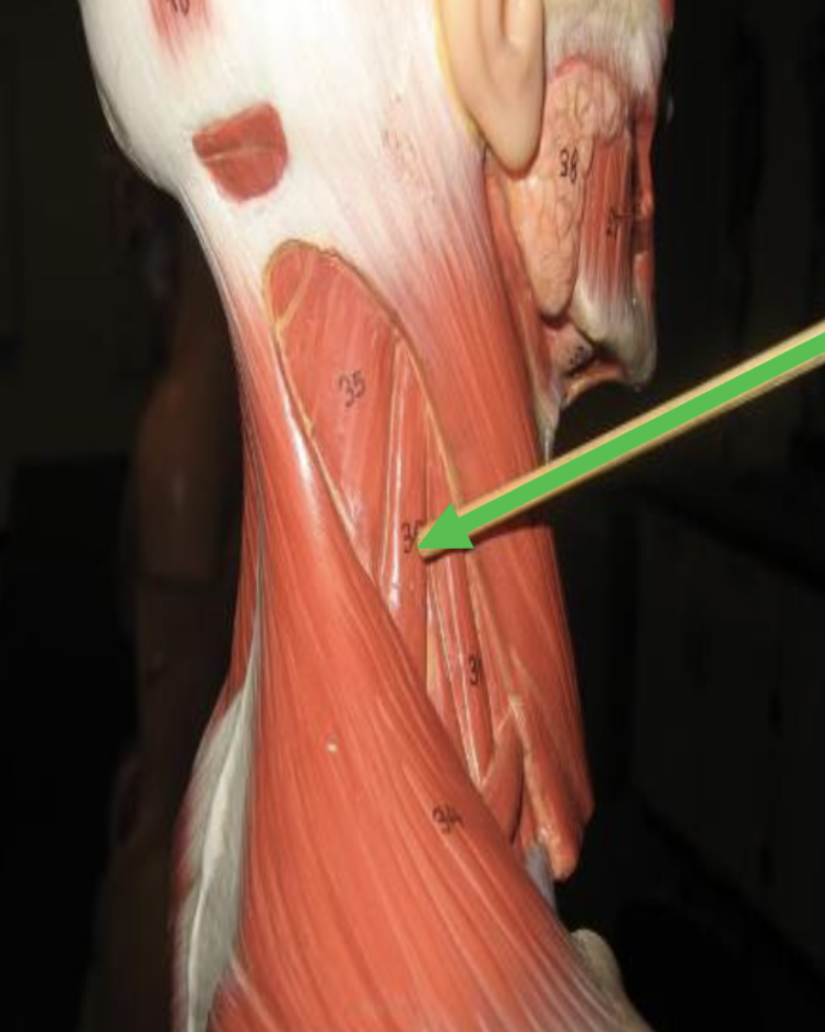 <p><span>Identify the muscle indicated by the pointer.</span></p>