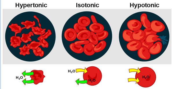 <p>Hypertonic solution:</p><p>• Higher solute content than ICF.</p><p>• Water moves out of cells and cells shrivel (crenated)</p><p></p><p>Isotonic solution:</p><p>• Balanced solute content to ICF.</p><p>• Free movement of water in balance</p><p></p><p>Hypotonic solution:</p><p>• Lower solute content than ICF.</p><p>• Water moves into cells and cells swell or lyse. </p>