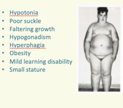 <p>- Insatiable appetite</p><p>- Slow metabolism</p><p>- Death from obesity diseases</p><p>- Small hands feet</p><p>- Feeding difficulty in infants</p>