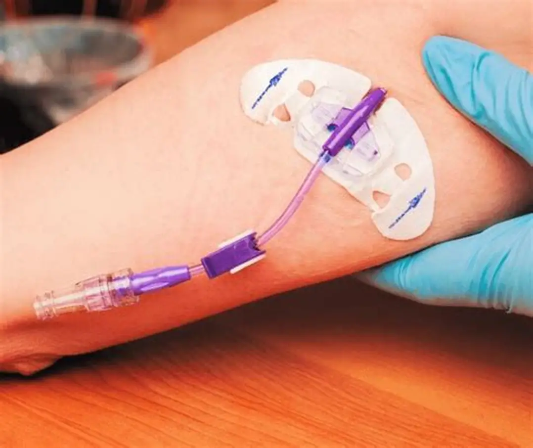 <p>What is the medical device shown in the image?</p>