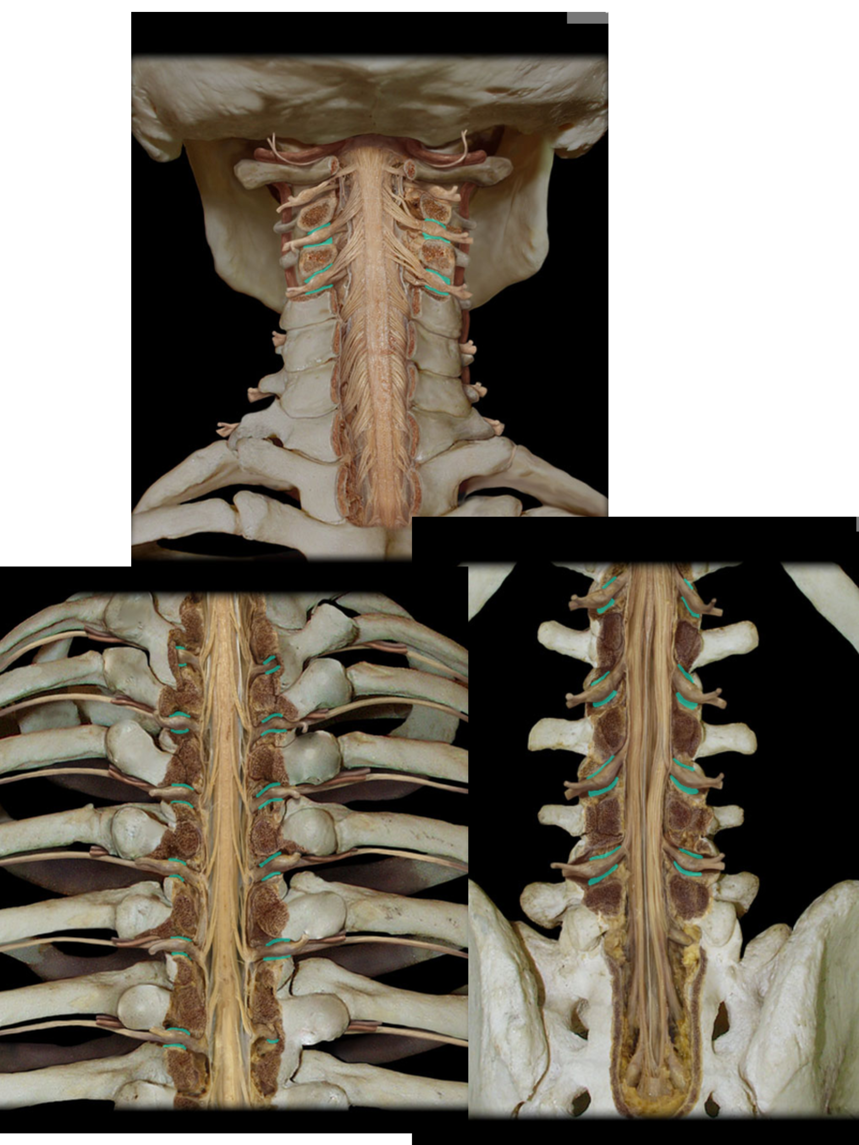<p>Intervertebral foramen</p>