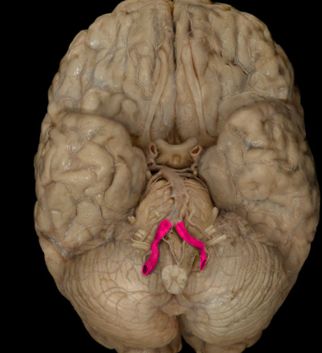 <p>each has ascended through the series of transverse foramen in the cervical vertebrae</p>