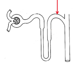 <p>DCT (Distal convoluted tubule)</p>
