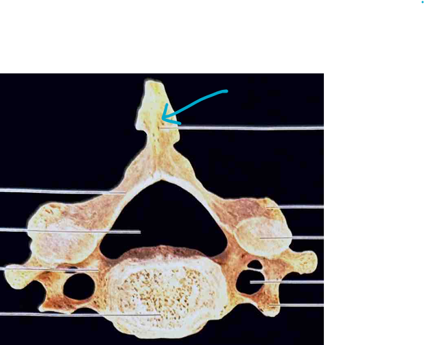 <p>ID vertebra</p>