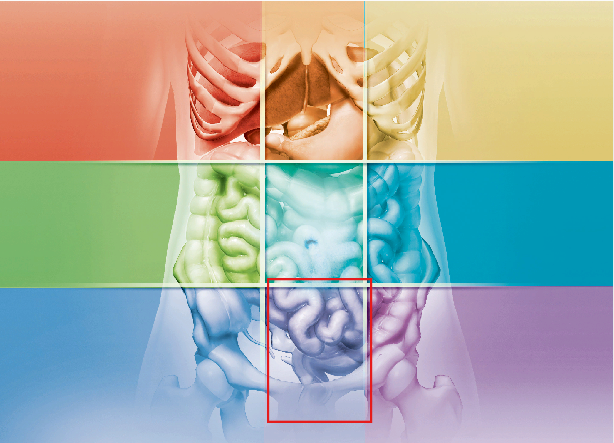 term image