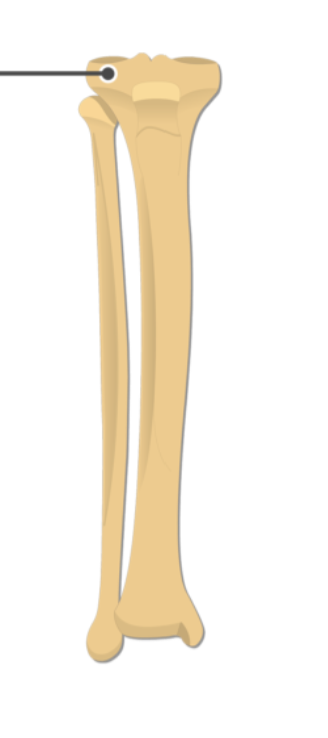<p>What is this pointing to? What bone is it on?</p>