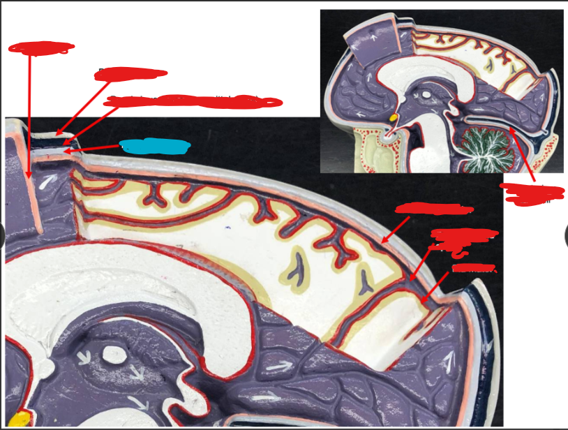 <p>Meninges (Brain) </p>