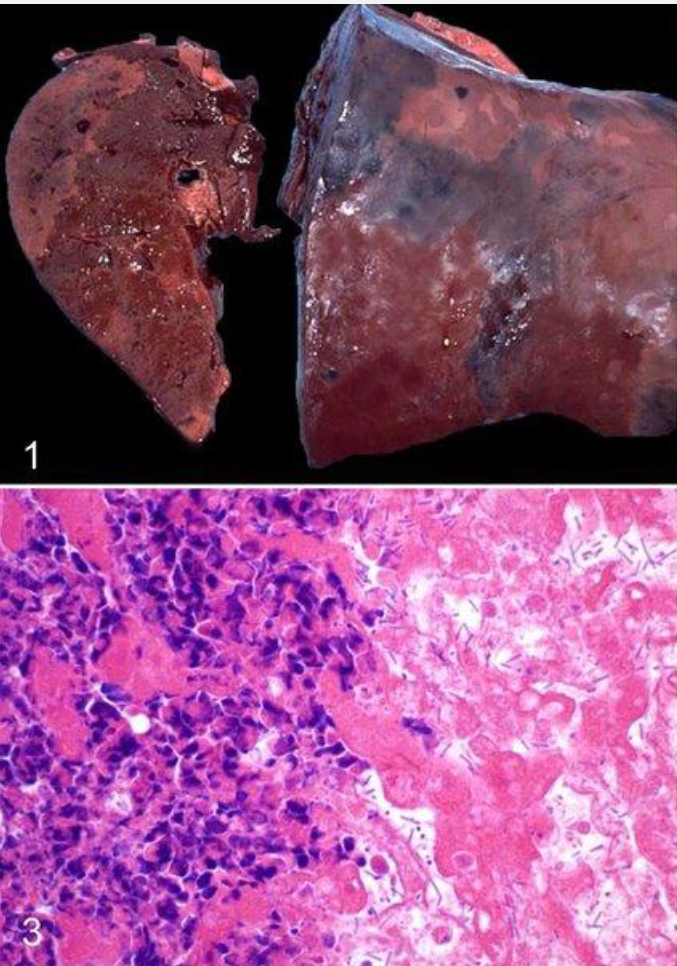 <p><span style="color: blue;">Black Disease</span>: Common name, caused by</p>