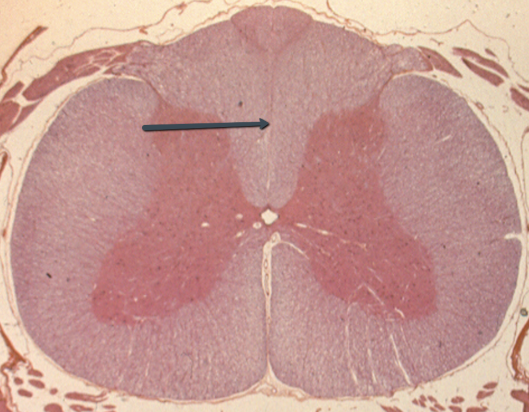 <p><span>Identify the structure indicated by the pointer.</span></p>