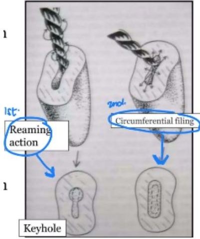 <p>enhances preparation when a flaring method is used by widening the orifice</p><p>first moved <span style="color: red;">toward the buccal side</span>, then reinserted and <span style="color: red;">removed slightly mesially</span></p><p>continues around the preparation to the<span style="color: red;"> lingual aspect </span>and then <span style="color: red;">to the distal</span> until all dentin walls have received rasping</p><p></p><p>(<em>oval canals common in premolars; introduce the file along the circumference of the canal)</em></p>