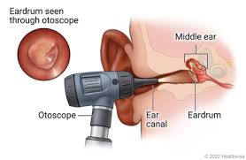 <p>medical examination using an otoscope (light magnifying device to inspect the ear canal, tympanic membrane and outer ear </p>