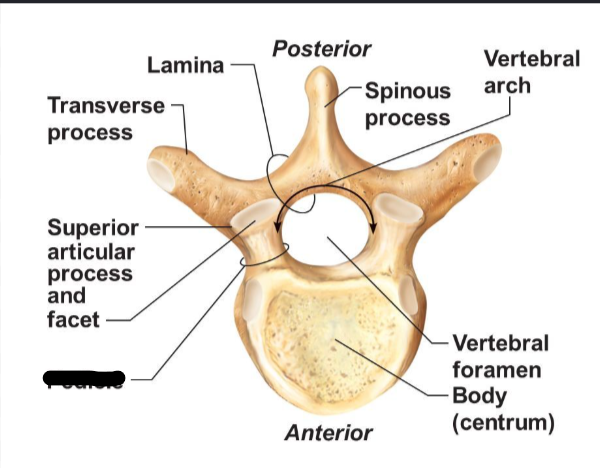 <p>What Boney Feature?</p>