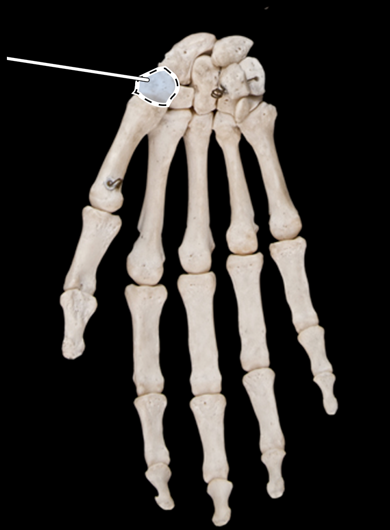 <p>anterior view</p>
