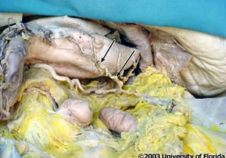 <p>what artery is pictured here?</p>