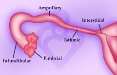 <p>1. Interstitial portion that runs into the uterine cavity and lies within the uterine wall.</p><p>2. The isthmus is the narrow part adjacent to the uterus.</p><p>3. The ampulla is the wider area of the tube lateral to the isthmus, where fertilization occurs.</p><p>4. The infundibulum is the wide, funnel-shaped terminal end of the tube. Fimbriae are finger-like processes that surround the infundibulum</p>