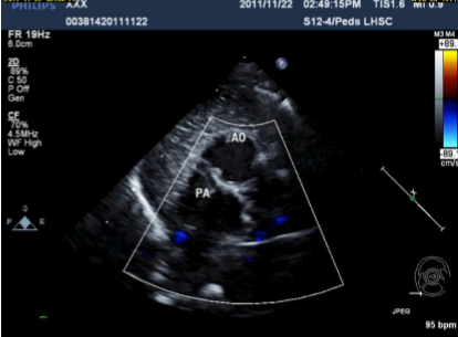 <p>Describe the findings of this image.</p>