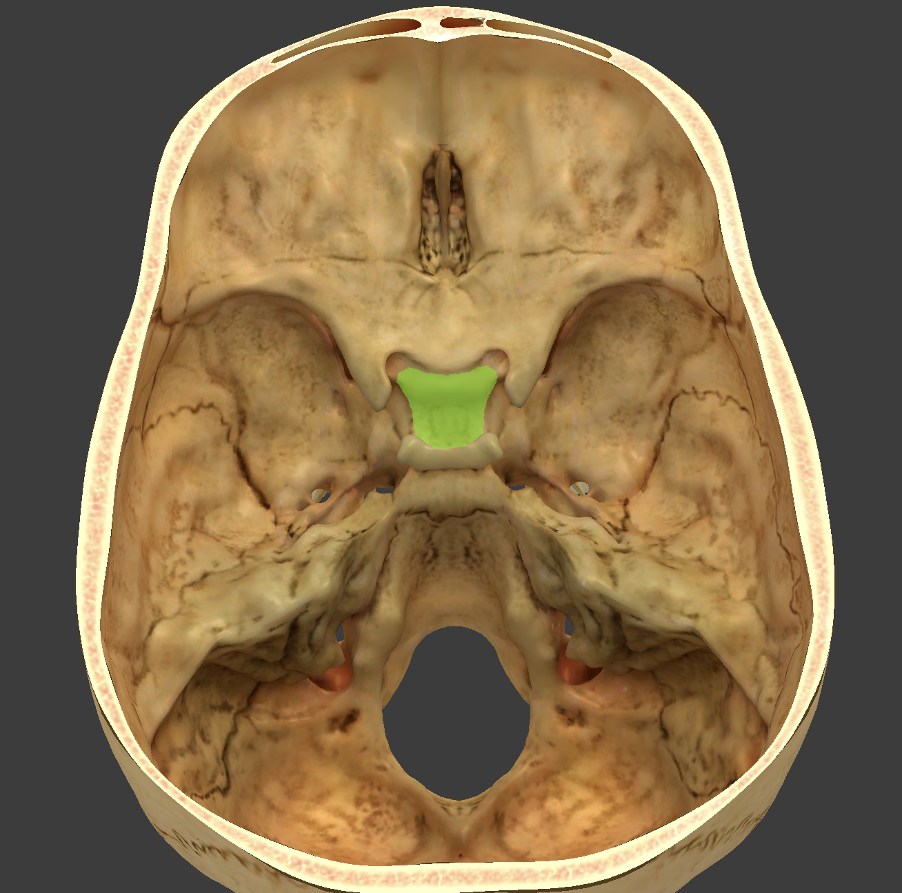 term image