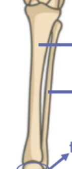 <p>What bone is this?</p>