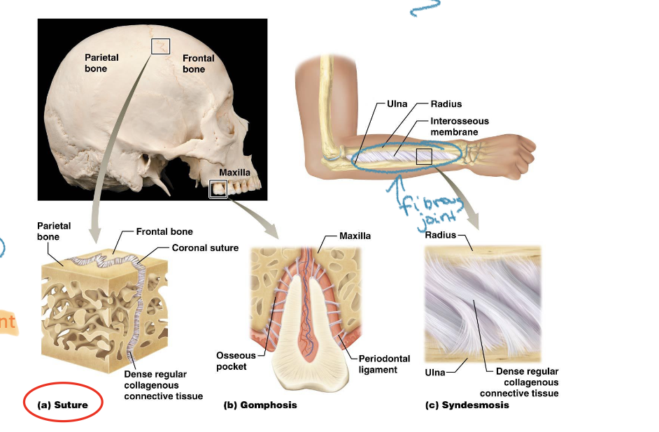 <p>-hold bones together with dense regular connective tissue rich in collagen fibers</p><p></p><p>**Know: suture joints in skull</p><p>(Fibrous= collagen fibers, dense regular CT)</p>