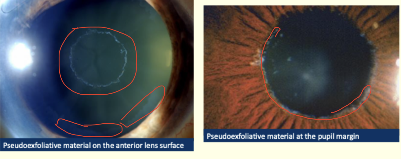 <p>Describe and give diagnosis </p>