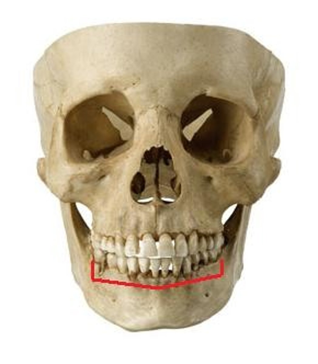 <p>ID part of bone outlined in red</p>