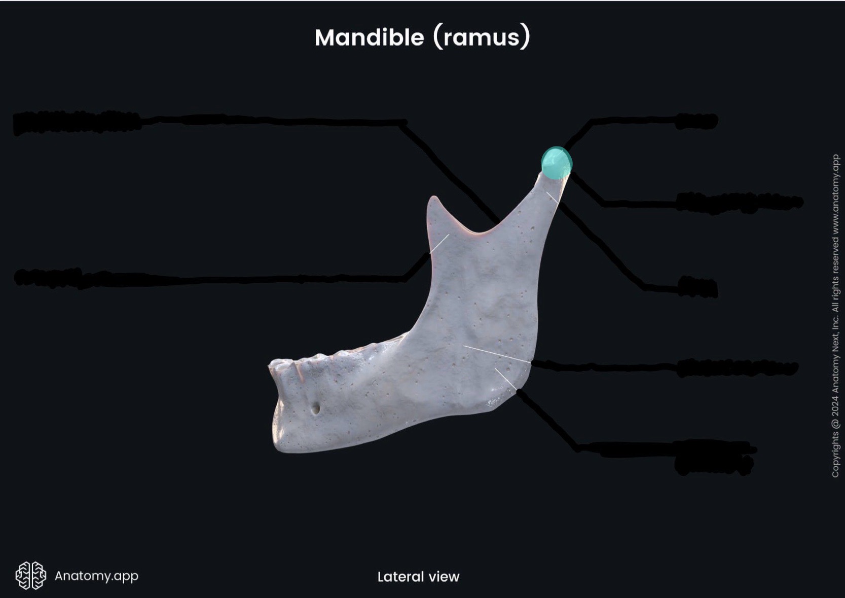 <p>What is the highlighted bony landmark</p>