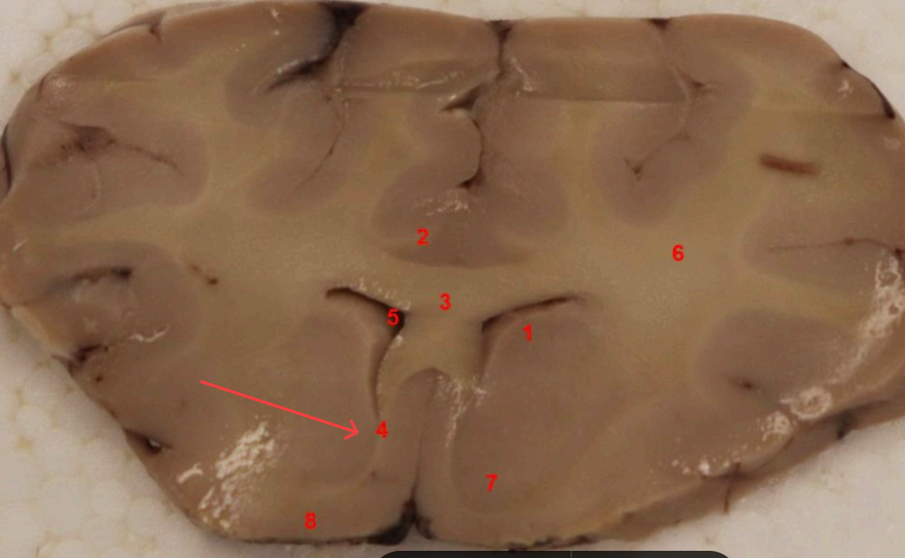 <p>what tract is this ? function? </p>