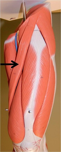 <p>What muscle is this?</p>