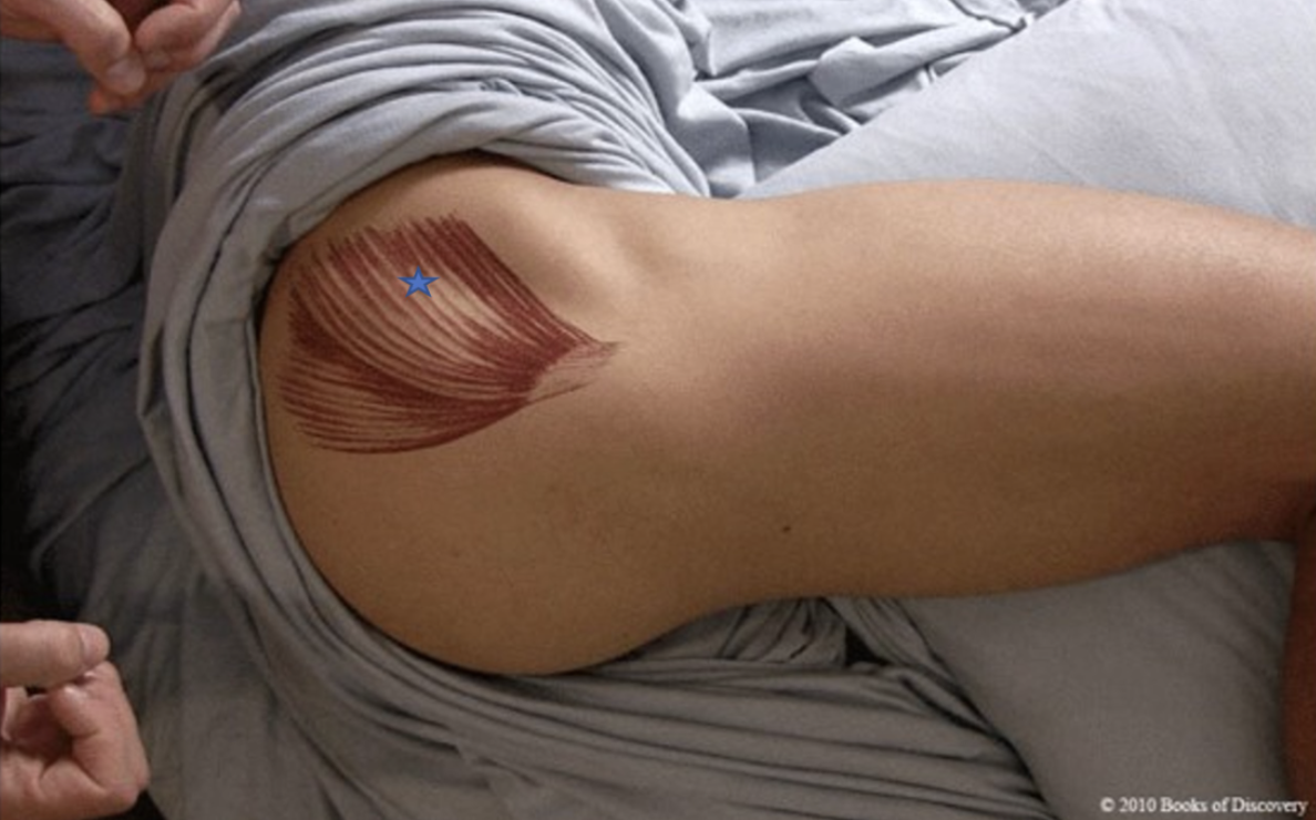 <p><span>From the list of muscles and actions below, identify the "starred" muscle and its primary actions.</span></p>