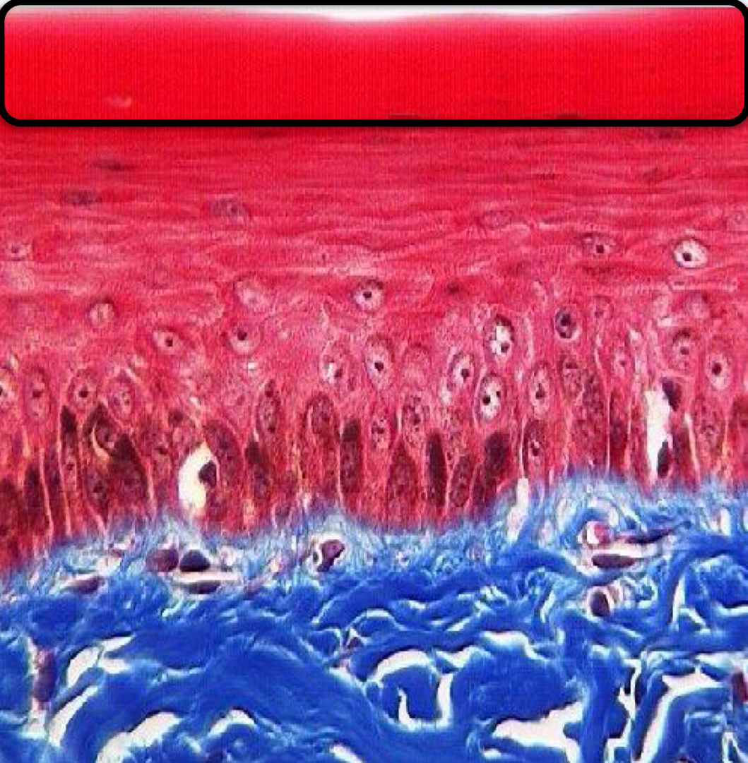 <p>What layer of the epidermis is this?</p>