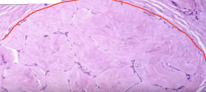 <p>What pathology?</p>