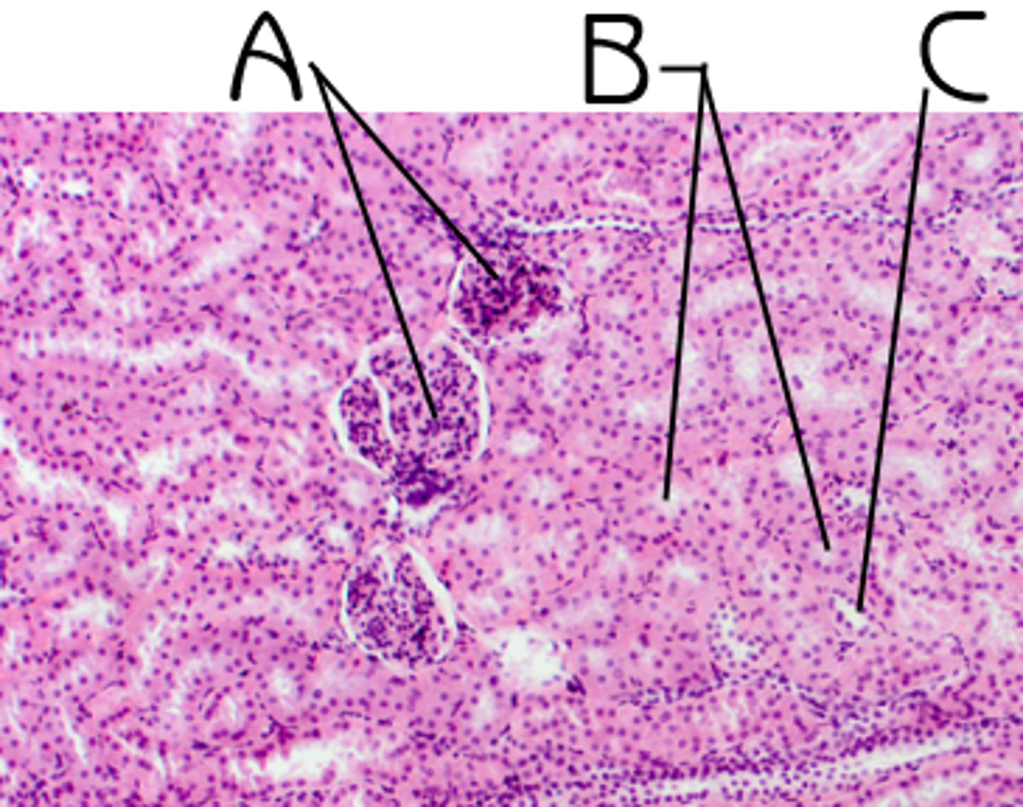 <p>A</p><p>Function: first site of filtration of blood in kidneys</p>